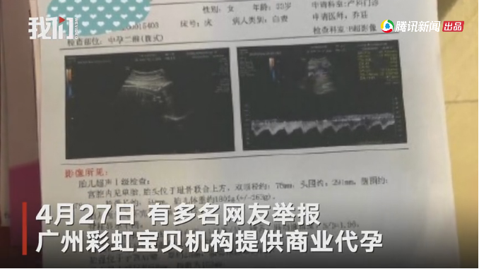 广州机构疑为男同代孕被举报，卫健部门已介入此事