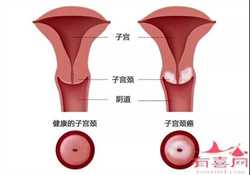 广州代孕生殖医院，广州捐卵试管代孕医院排名，附捐卵试管费用明细！